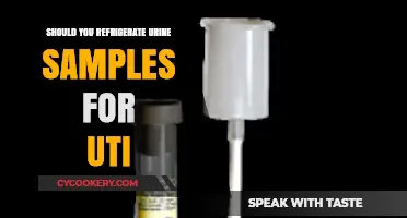 Refrigerating Urine Samples for UTI Testing: Necessary or Not?