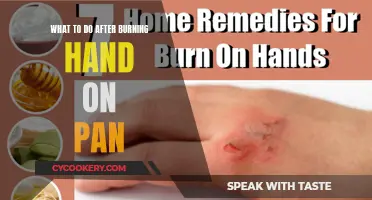 Heal Hand Burns: Quick Steps to Take After Pan Scalds