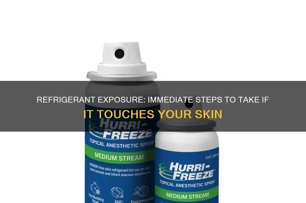 what to do if refrigerant touches you