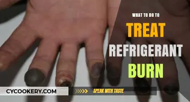 Treating Refrigerant Burns: Essential Steps for Immediate Relief and Recovery