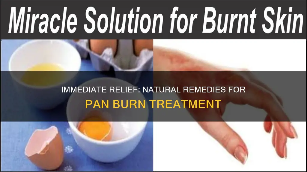 what to put on a burn from pan