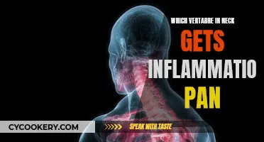 Understanding Neck Pain: Inflammation in the Vertebrae