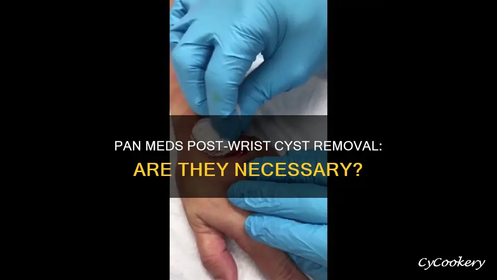 will I need pan med after wrist amgkiin cyst removal